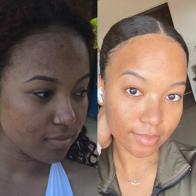 Trusted by Over 10,000+ Women (And the Dermatologists Who Finally Believe in Topical Collagen)