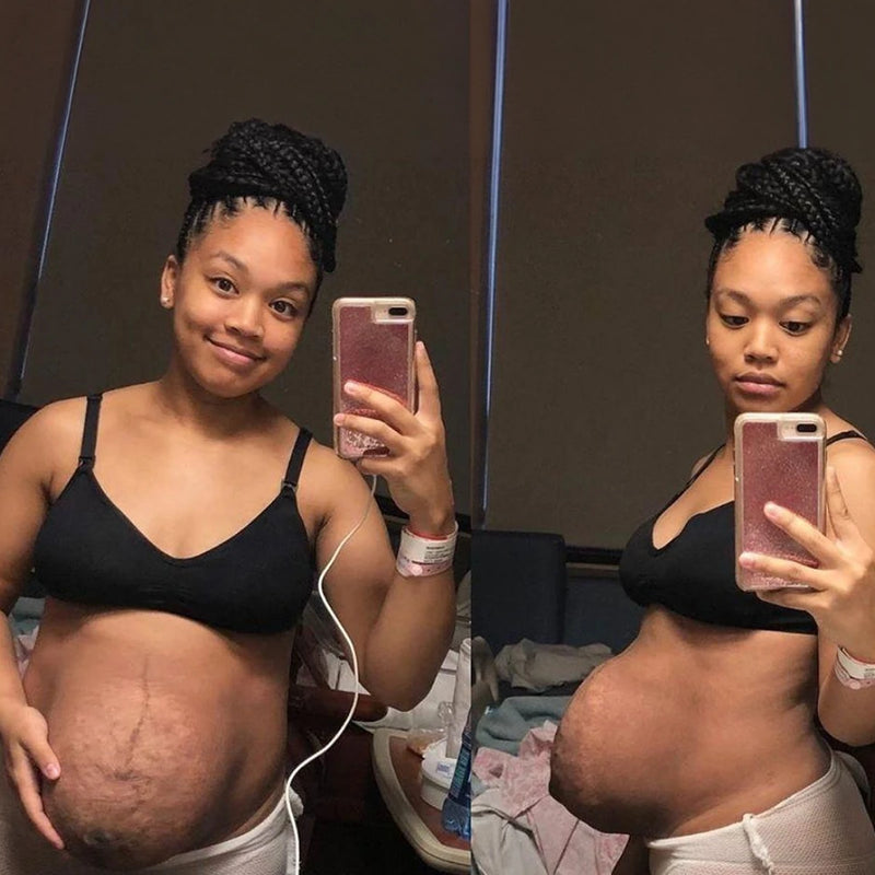 2. The Post-Pregnancy Belly Solution Women Have Been Waiting For