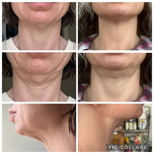 1. It Tightens Neck Skin That Most Women Believed Was Beyond Saving
