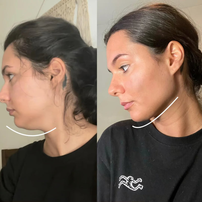 Your Jawline Comes Back Before You Finish Getting Dressed