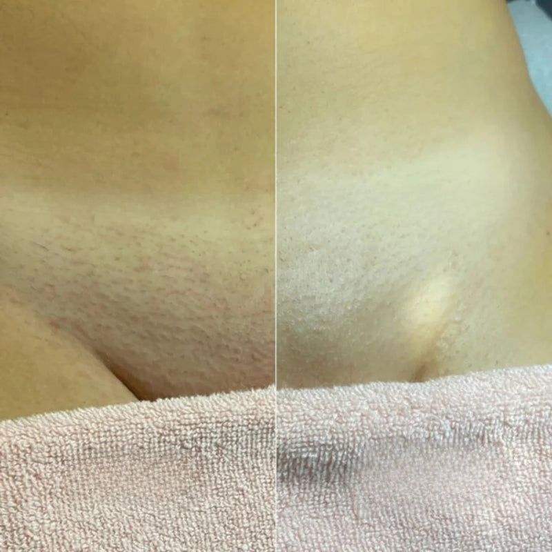 Safe for Your Most Sensitive Areas: Face, Body, and Intimate Zones