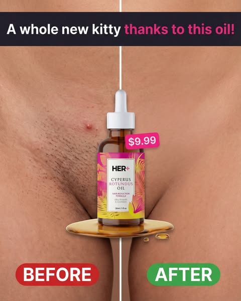 Heals Your Skin While Weakening Hair (No More Bumps, Burns, or Dark Spots)