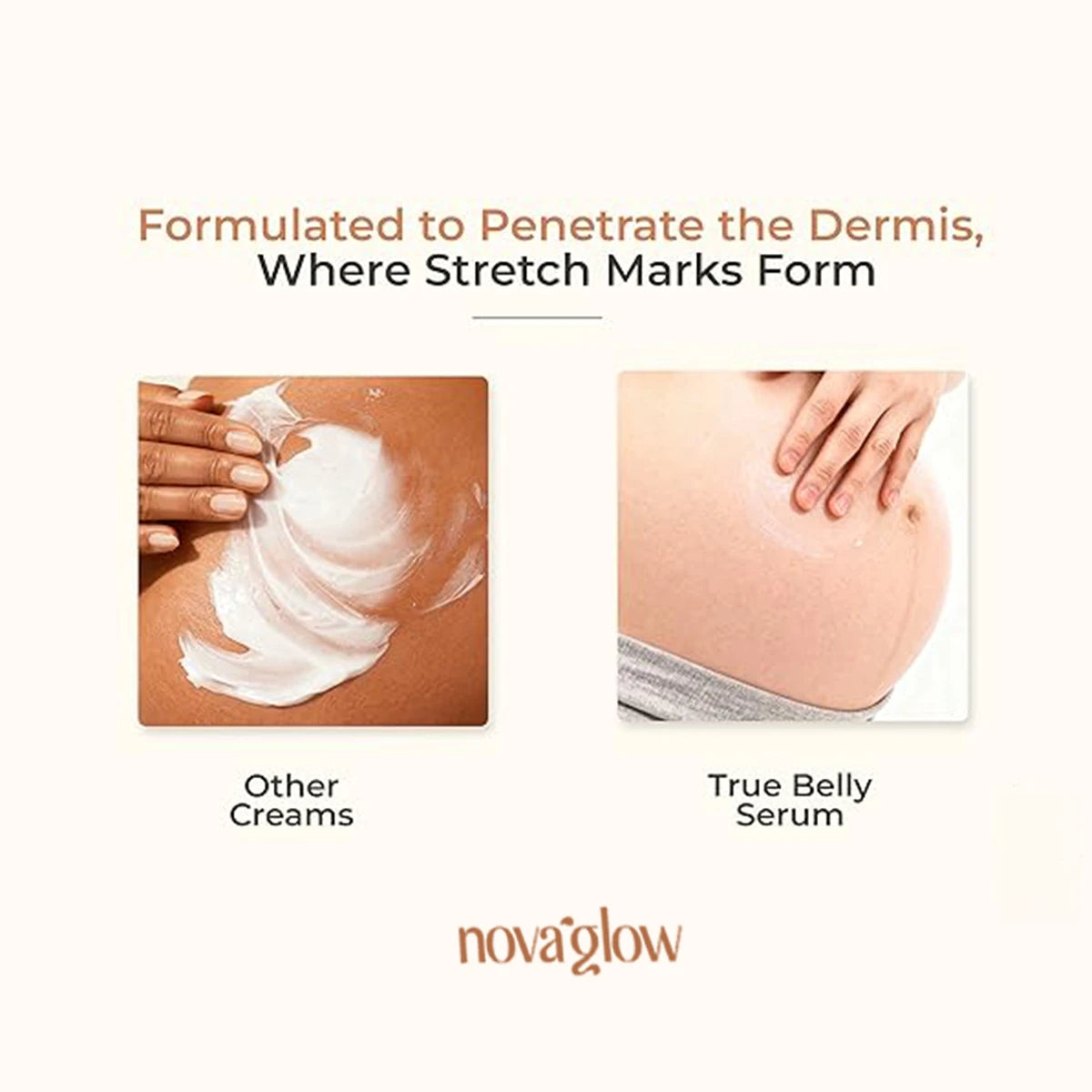 NovaGlow's Belly Serum