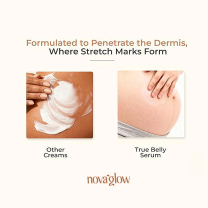NovaGlow's Belly Serum
