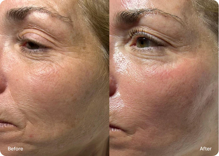72-Hour Hydration That Plumps Skin While Peptides Rebuild Collagen