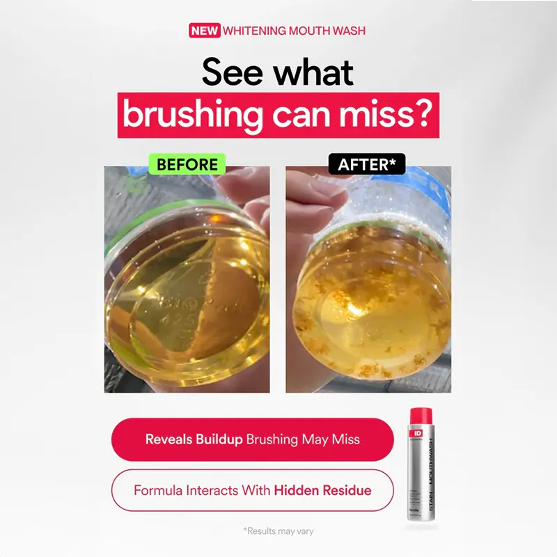 Enjuague bucal blanqueador