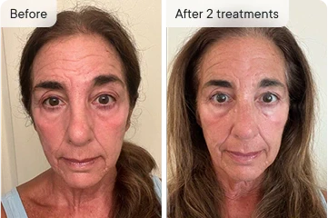 Delivers Long-Lasting Results That Don't Fade When You Skip a Week