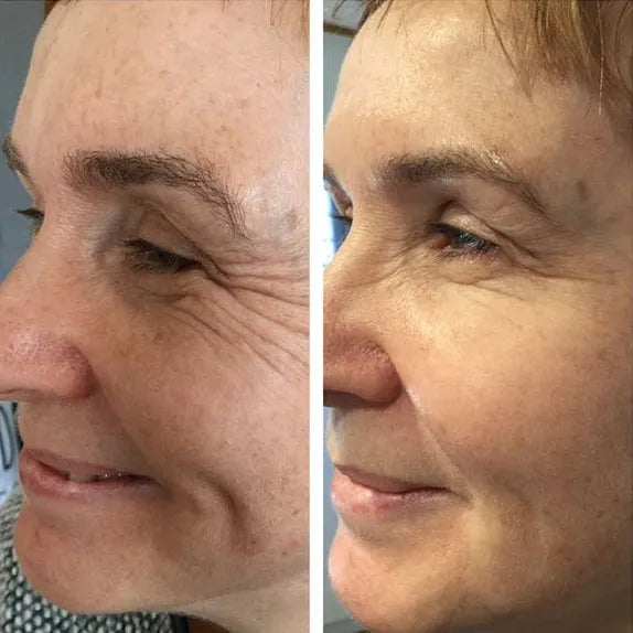 72-Hour Deep Hydration That Actually Lasts