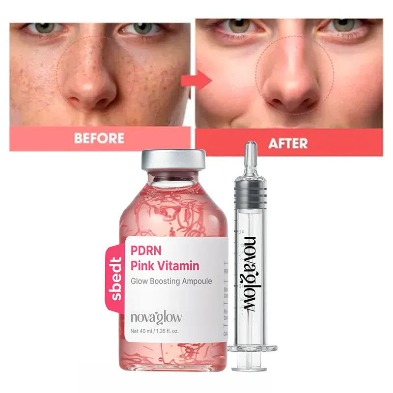 Korean Vitamin Glow Boosting Ampoule