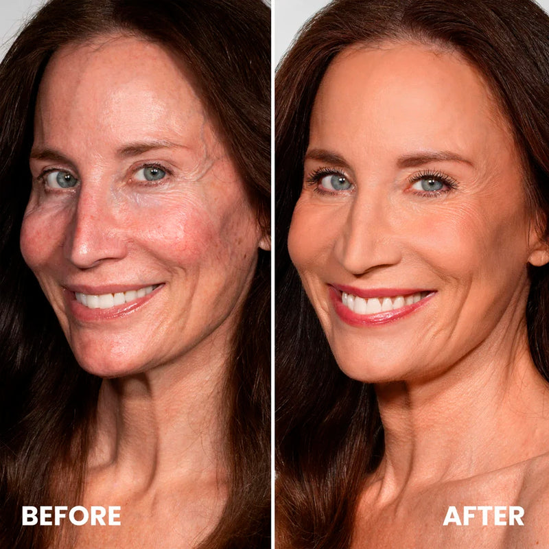 3. It Restores That Plump, Dewy Look You Used to Have